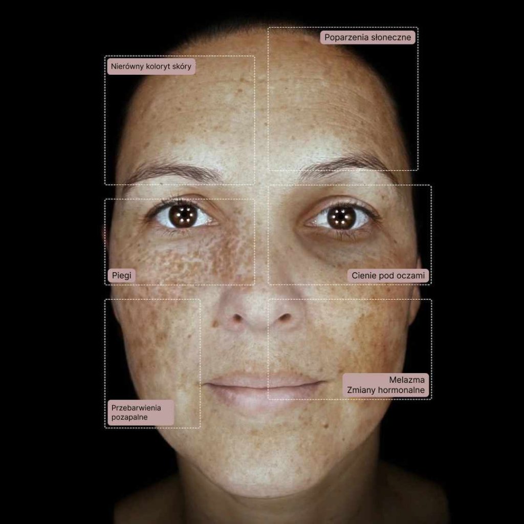 obraz twarzy poddanej badaniu z wykorzystaniem różnych źródeł światła - analiza skóry w Paro Clinic